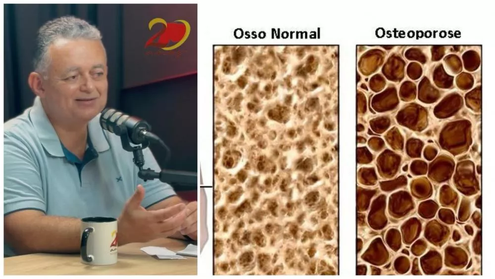 Ortopedista Dr. Fernando Jucá alerta sobre osteoporose em entrevista ao Podcast Patos Online