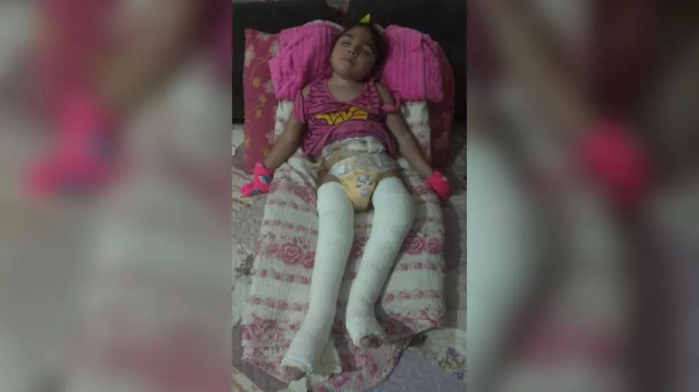 Família de Condado-PB segue com campanha para ajudar Ana Vitória, de 3 anos, a passar por cirurgia urgente e conquistar mais qualidade de vida