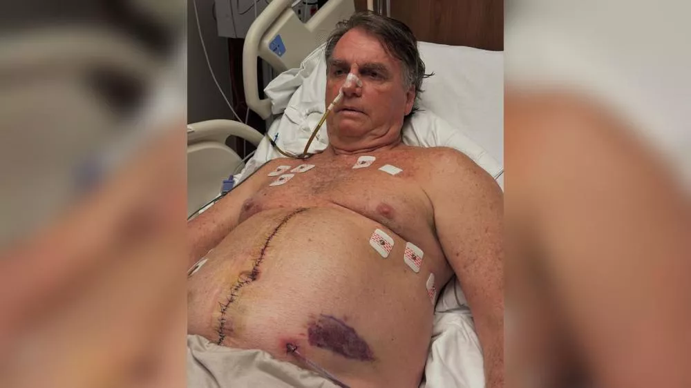 Bolsonaro tem dreno retirado, não tem febre e segue com boa evolução clínica, diz boletim