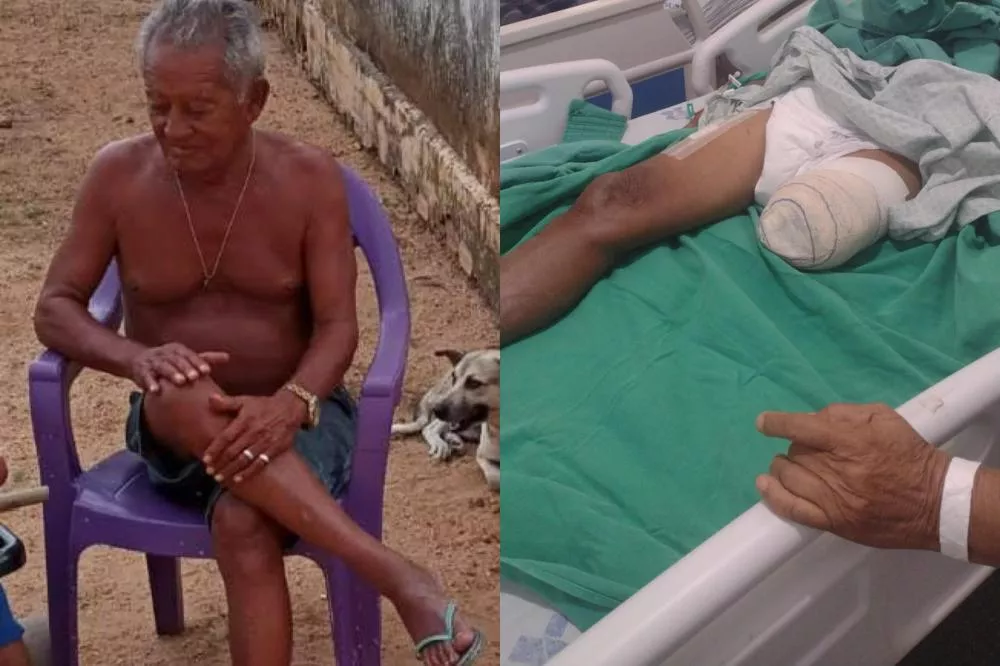 Família busca doação de cadeira de rodas e cadeira de banho para idoso que teve a perna amputada em decorrência da diabetes