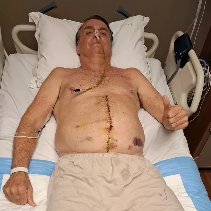 Bolsonaro apresenta “piora clínica” e pressão arterial elevada, diz boletim