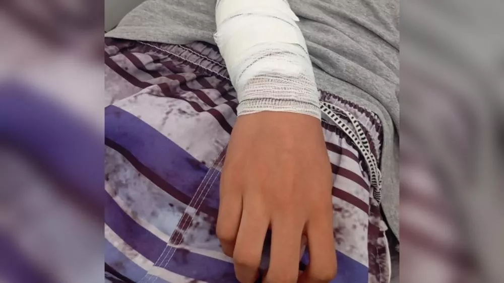 Adolescente de 15 anos é atacado por pitbull enquanto caminhava até a escola em João Pessoa; tutor do animal fugiu do local