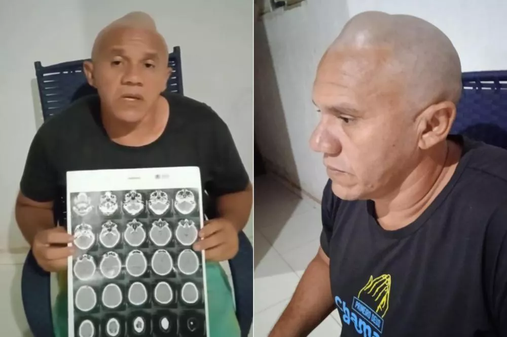 Em Patos: servente de pedreiro faz apelo por cirurgia urgente para retirada de lipoma na cabeça
