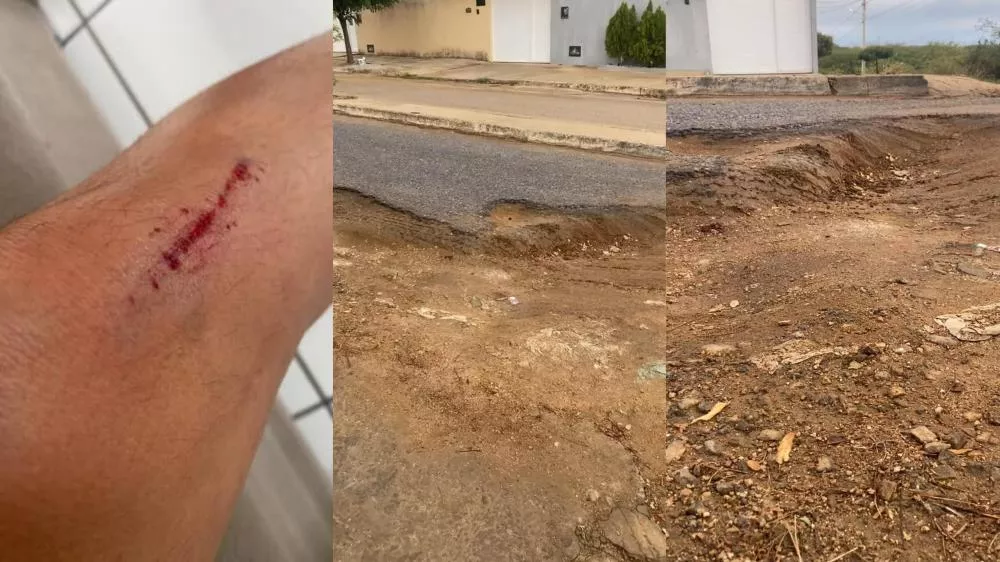 Moradora relata acidente causado por buraco na via principal do Bairro dos Estados e denuncia abandono