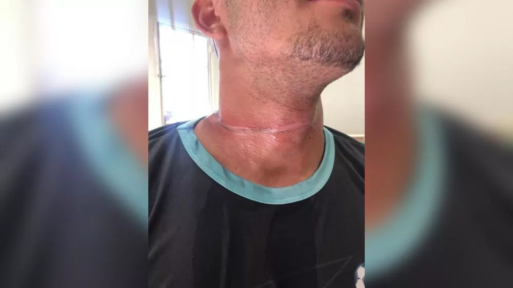 Motociclista atingido por fio solto em rua de Patos será indenizado em R$ 6 mil por empresa de internet