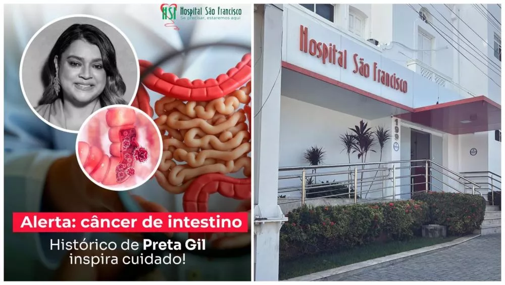 Hospital São Francisco reforça alerta sobre câncer de intestino após morte de Preta Gil: “Falar sobre saúde é um gesto de amor”