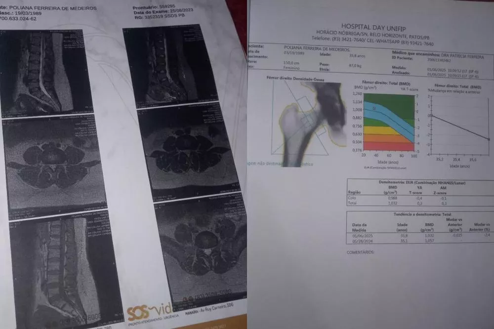 Moradora de São Mamede pede ajuda para custear medicação contra dores e tratamento de osteoporose