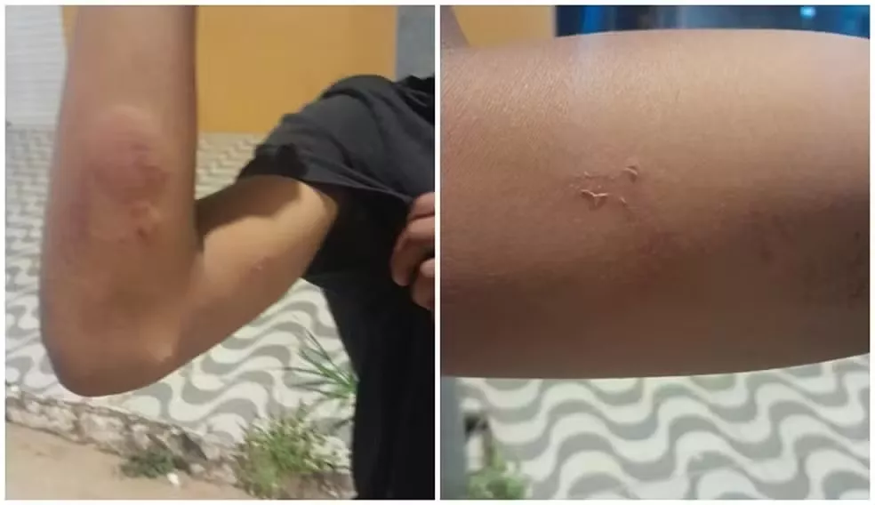 Professores são suspeitos de agredir alunos em escolas da Paraíba; casos foram registrados em Curral de Cima e Aroeiras