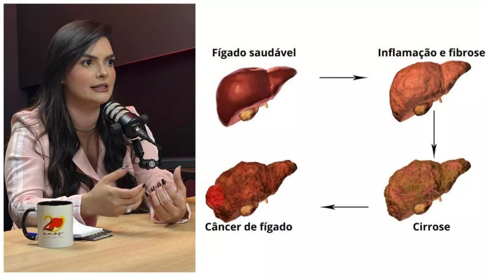 Hepatologista alerta: uso frequente de anti-inflamatórios pode causar cicatrizes no fígado e evoluir para cirrose