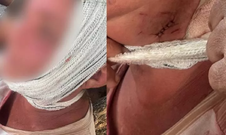 No Sertão: Mulher é ferida no pescoço após negar relação sexual durante tentativa de abuso