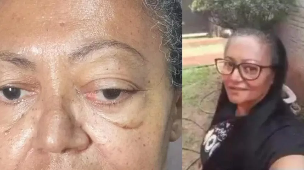 Patosense pede ajuda para realizar cirurgia urgente e evitar perda total da visão