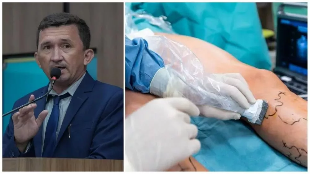 Vereador Galeguinho da Van volta a cobrar médico angiologista para atender pacientes do Frei Damião, em Patos