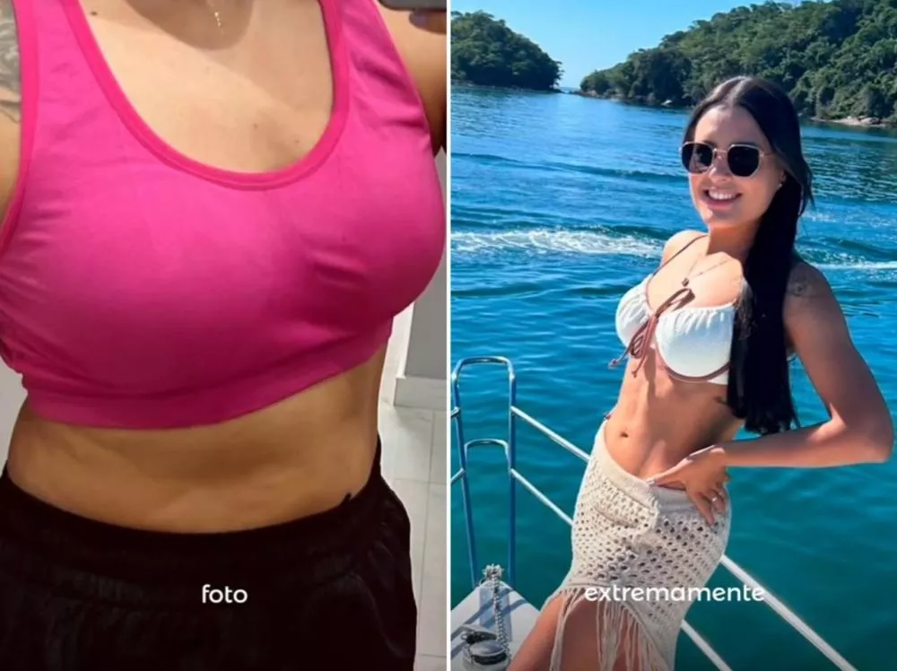 Transformação da Paciente do Dr. Paulo Arnon - Foto: Reprodução