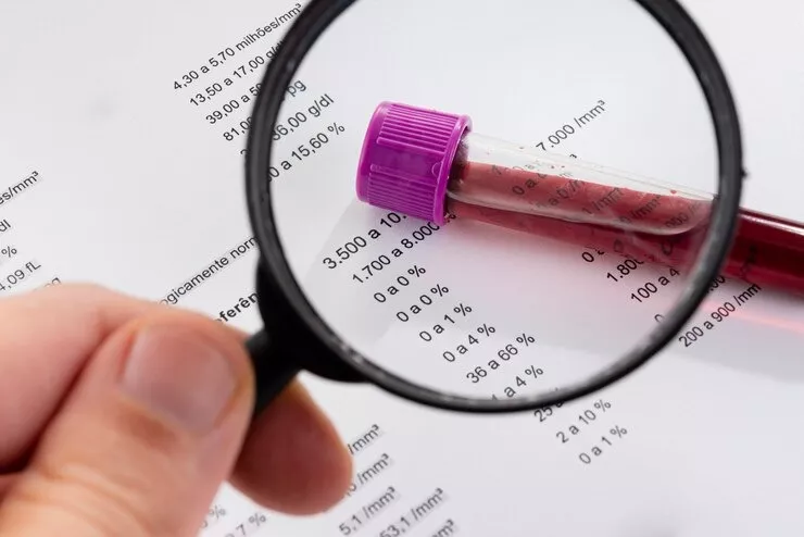 Procon/Patos divulga pesquisa de preços de exames laboratoriais