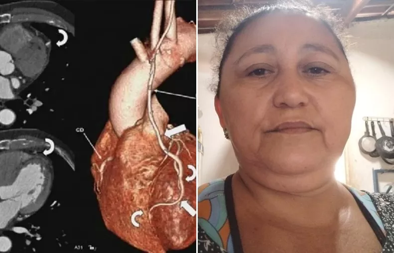 Moradora de Patos faz campanha para arrecadar R$ 1,6 mil e realizar exame cardíaco de alta complexidade