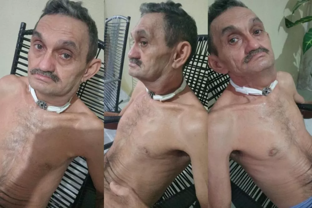 Família pede ajuda para homem de São José do Bonfim que enfrenta problemas de saúde