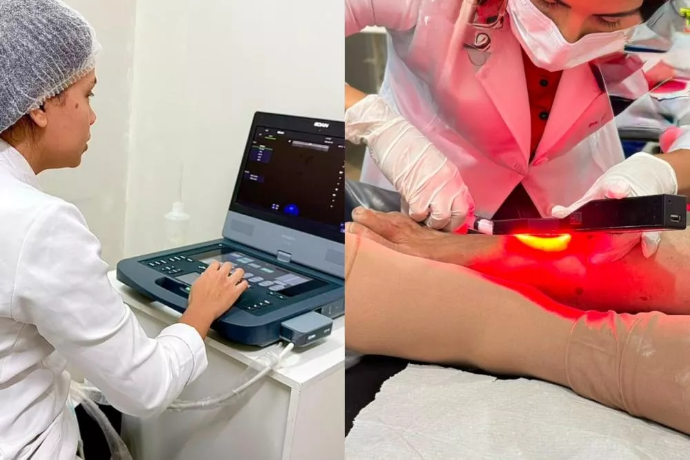 Opera Paraíba amplia tratamento de varizes e realiza procedimentos em Patos-PB