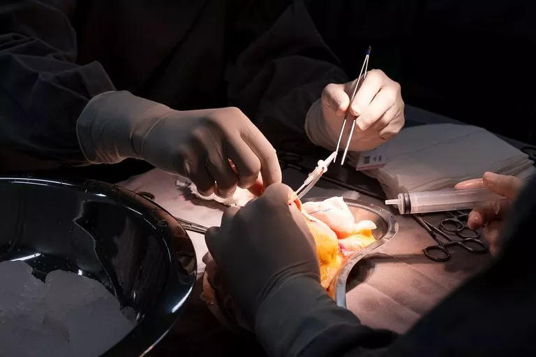 Jovem de Cajazeiras é beneficiado com primeiro transplante renal 100% SUS realizado no Hospital da Mulher, na Paraíba