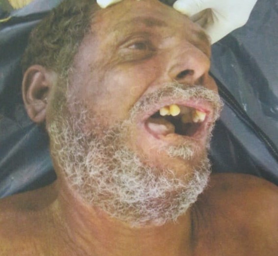 Corpo de homem morto em Patos é reconhecido e liberado para sepultamento