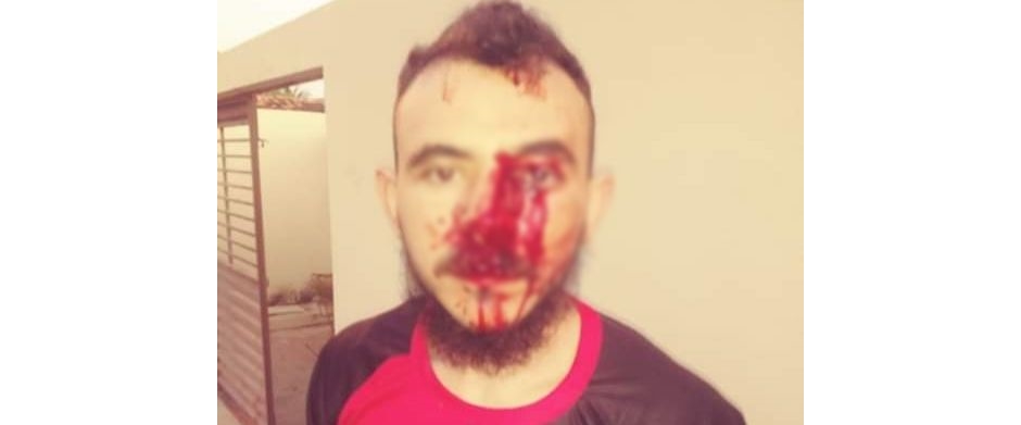 Jovem de Catingueira é fortemente agredido por dois homens nesta segunda-feira (30)