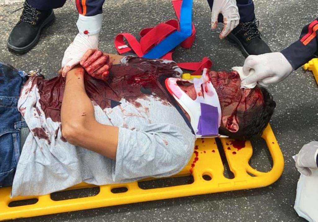 Colisão traseira entre veículos deixa motorista bastante ferido na cidade de Patos