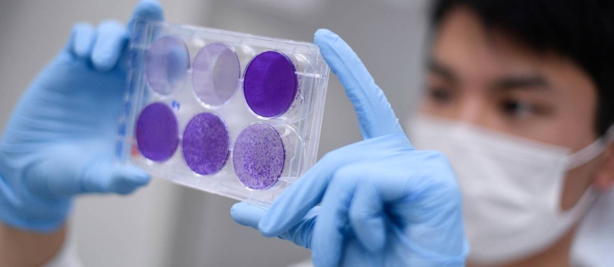 País tem maior número de mortes por Covid em 24 horas desde início da pandemia