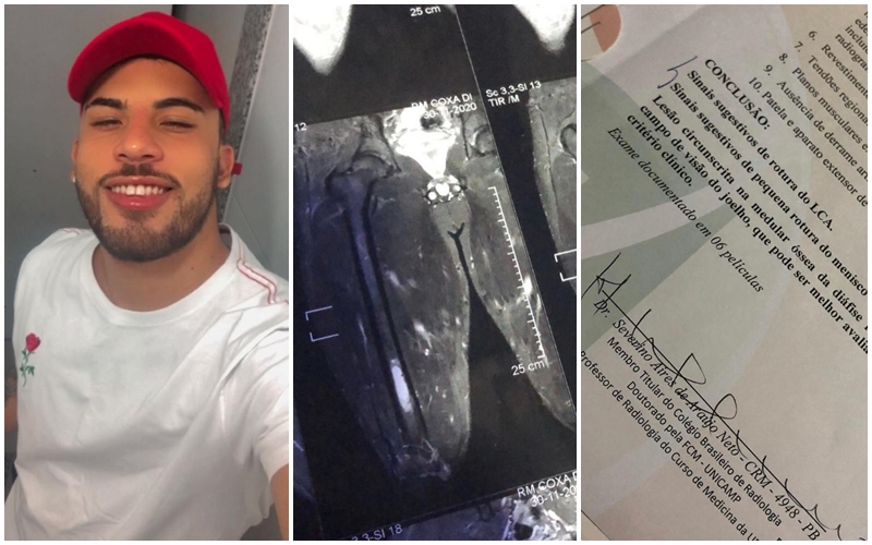 Jovem de Pombal é diagnosticado com um possível encondroma, tipo de tumor e usa suas redes sociais para pedir ajuda