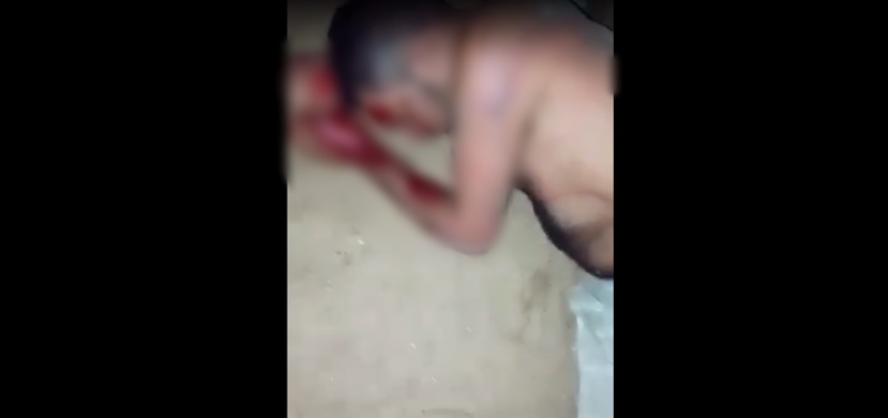 Homem é espancado na zona rural de Taperoá e por pouco não é morto a pauladas