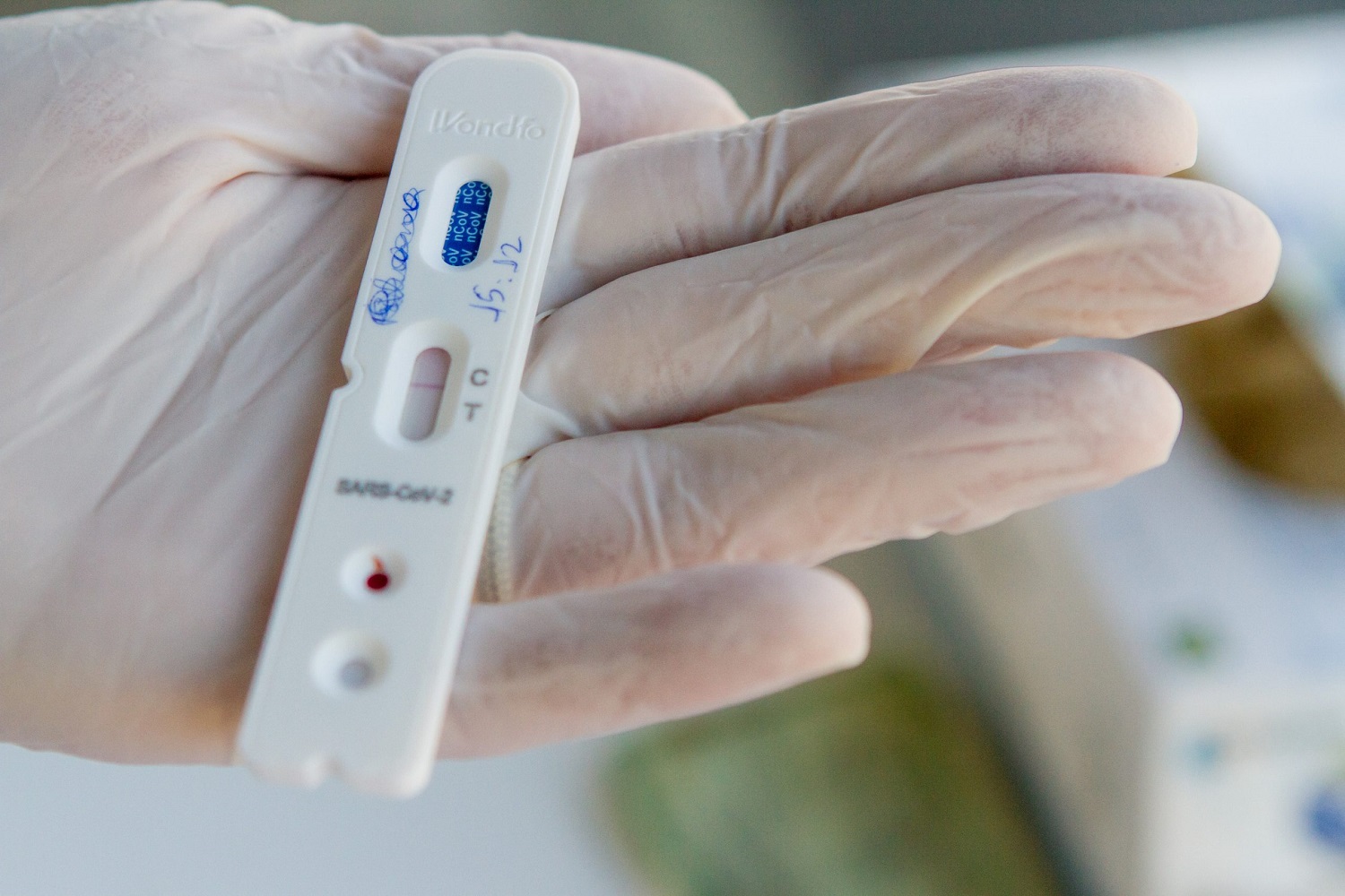 PB registra mais 47 mortes por Covid-19; estado já tem 260 mil infectados