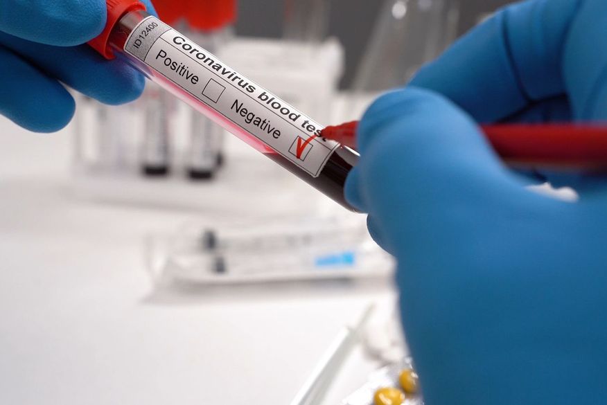 Paraíba confirma 34 mortes e 1.272 novos casos de Covid-19 nesta sexta-feira