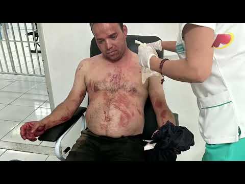 Vereador de Desterro vítima de r0ubo na noite desta quarta (04) fala pela primeira vez sobre o caso